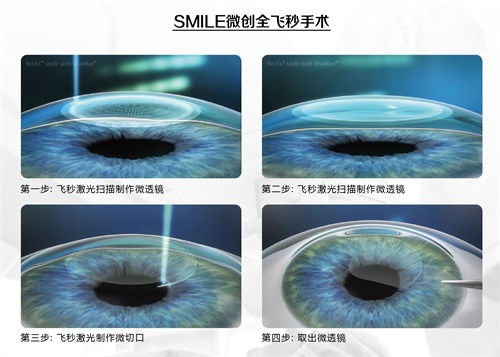 眼科謠言，你的“好心轉(zhuǎn)載”辦了多少壞事