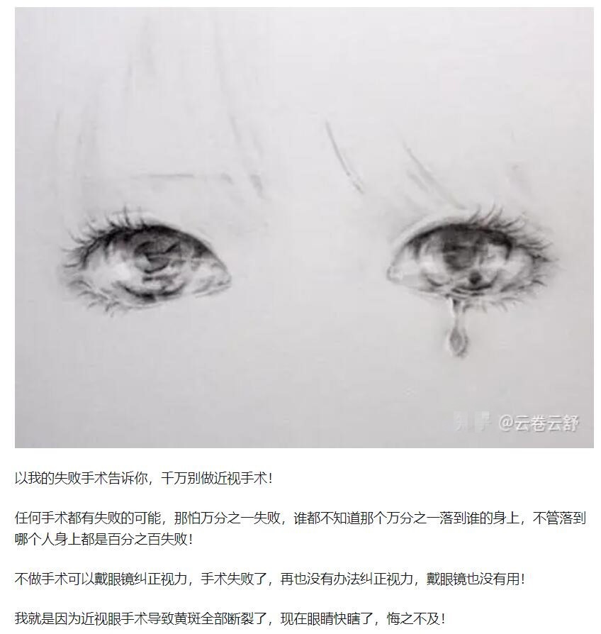 教你，怎樣去了解近視手術(shù)  